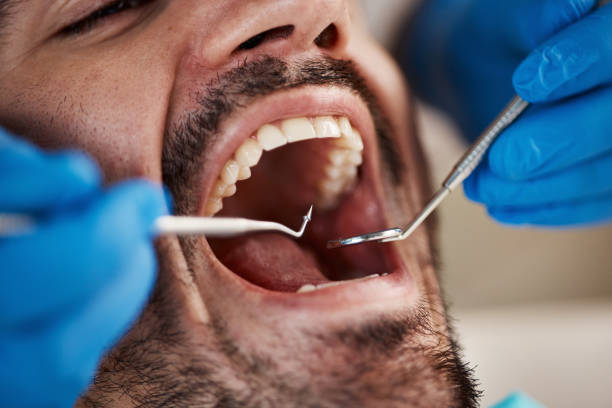 Best Emergency Gum Pain Relief  in Woodward, IA