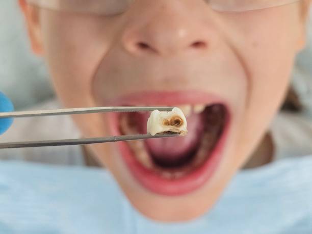Best Emergency Tooth Extraction  in Woodward, IA